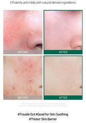 Some By Mi AHA.BHA.PHA 30Days Miracle Serum - 50ML SOME BY MI