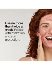 The Ordinary AHA 30%+ BHA 2% Peeling Solution - 30ml The Ordinary