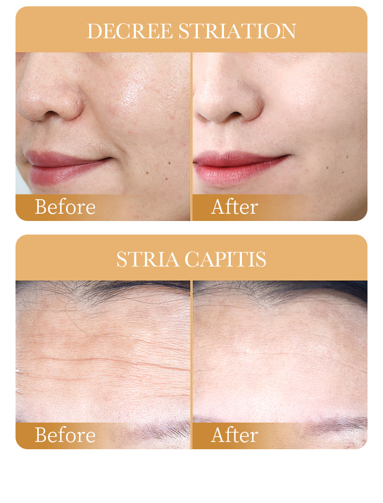 Collagen 5 in 1 Skin Care Combo Sadoer