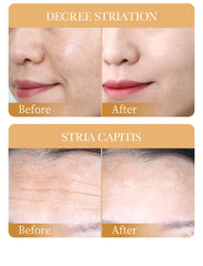 Collagen 5 in 1 Skin Care Combo Sadoer