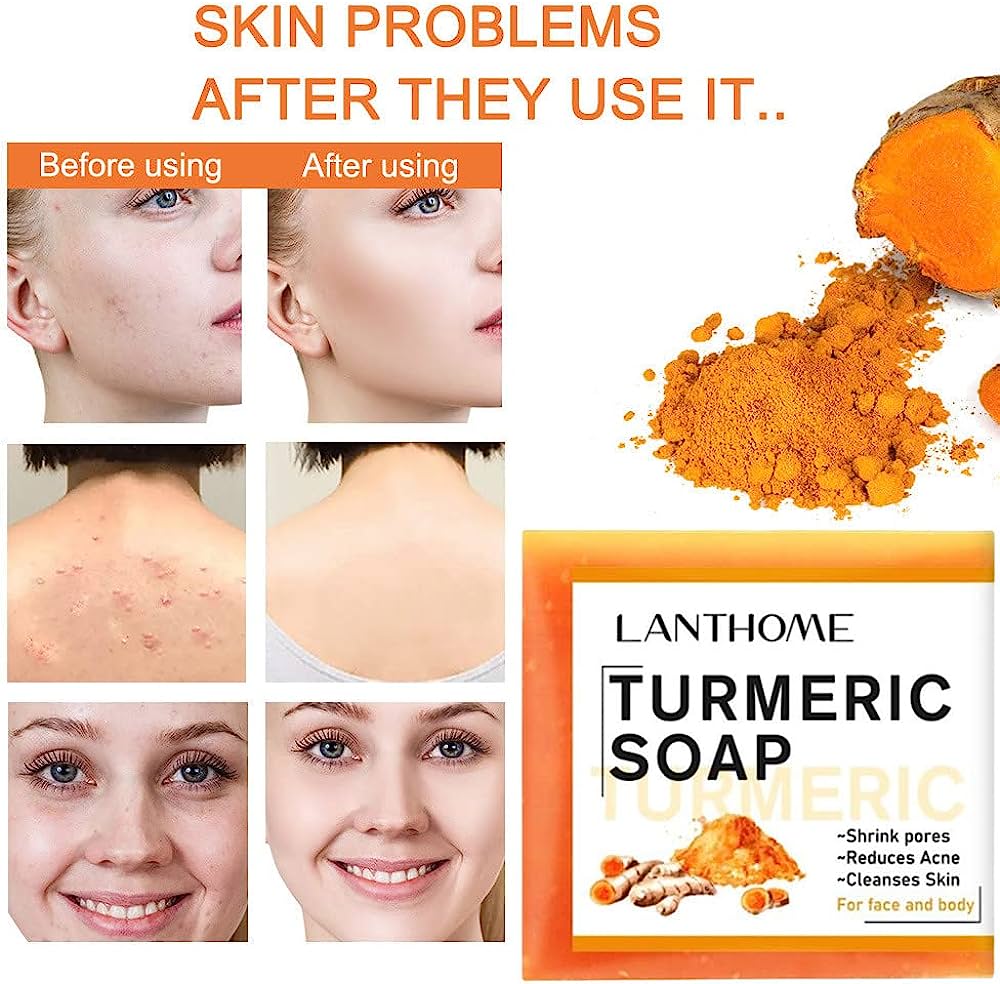 Lanthome Turmeric Soap - 100g LANTHOME