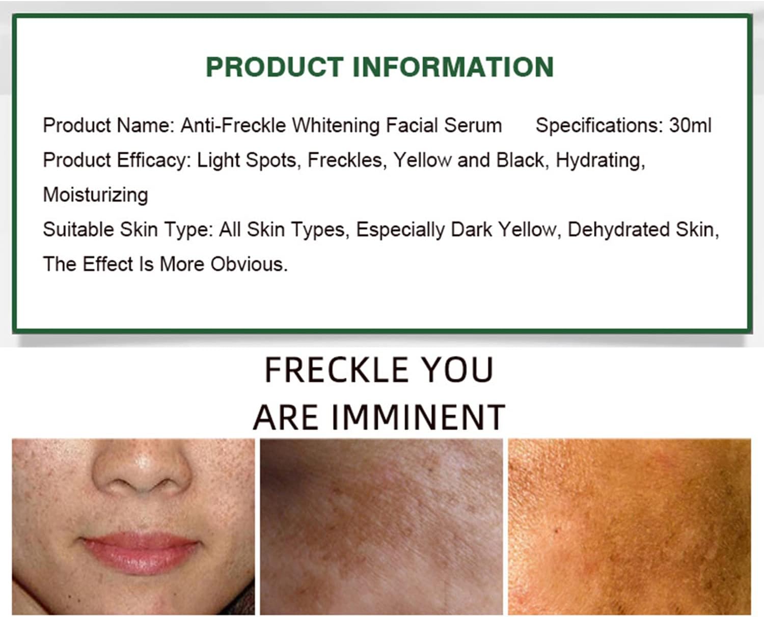 Aichun Beauty Anti-freckle Whitening Facial Serum - 30ml Aichun Beauty