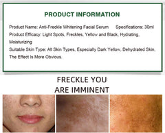Aichun Beauty Anti-freckle Whitening Facial Serum - 30ml Aichun Beauty