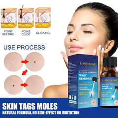 Lanthome Wart Remover - 10ml LANTHOME