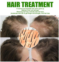 Neo Hair Lotion - 120ml Neo