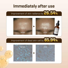 Some By Mi Galactomyces Pure Vit C Glow Serum - 30ml SOME BY MI