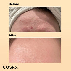 COSRX Advanced Snail Cream and Essence Combo COSRX