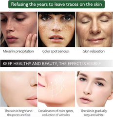 Aichun Beauty Anti-freckle Whitening Facial Serum - 30ml Aichun Beauty