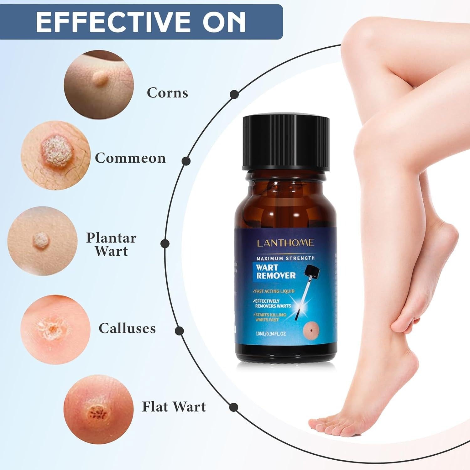 Lanthome Wart Remover - 10ml LANTHOME
