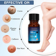 Lanthome Wart Remover - 10ml LANTHOME