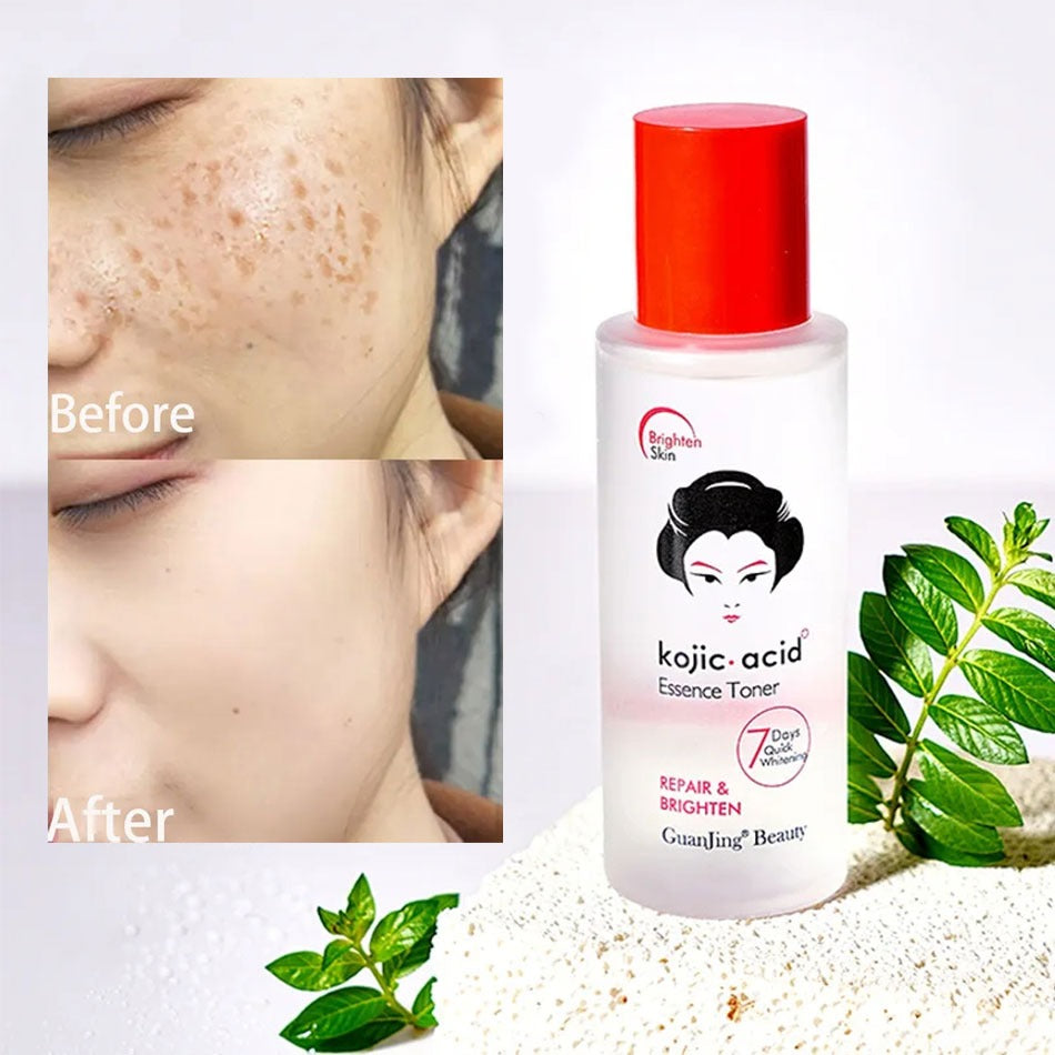 Guanjing Kojic Acid Essence Toner Repair & Brighten - 100ml GuanJing Beauty