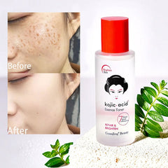 Guanjing Kojic Acid Essence Toner Repair & Brighten - 100ml GuanJing Beauty