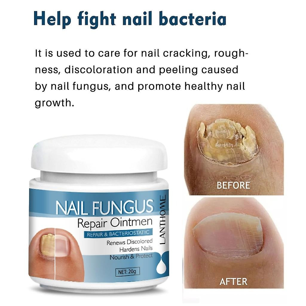 Lanthome Nail Fungus Repair Ointmen - 20g LANTHOME