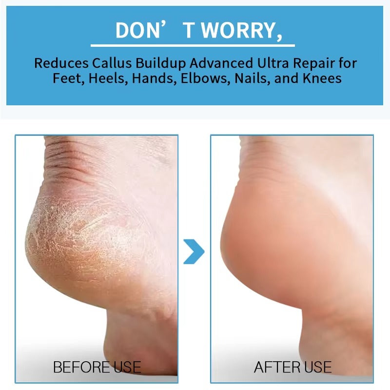 Lanthome Foot Peeling Spray - 50ml LANTHOME