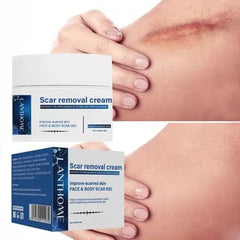 Lanthome Scar Removal Cream - 30g LANTHOME