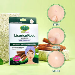 Aichun Beauty LicoriceRoot Acne Pimple Patch Aichun Beauty
