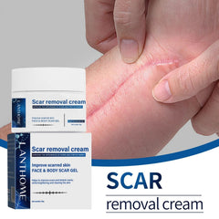 Lanthome Scar Removal Cream - 30g LANTHOME