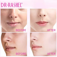 Dr.Rashel white Fade spot Toner - 100ml DR.RASHEL