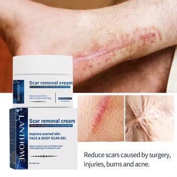 Lanthome Scar Removal Cream - 30g LANTHOME