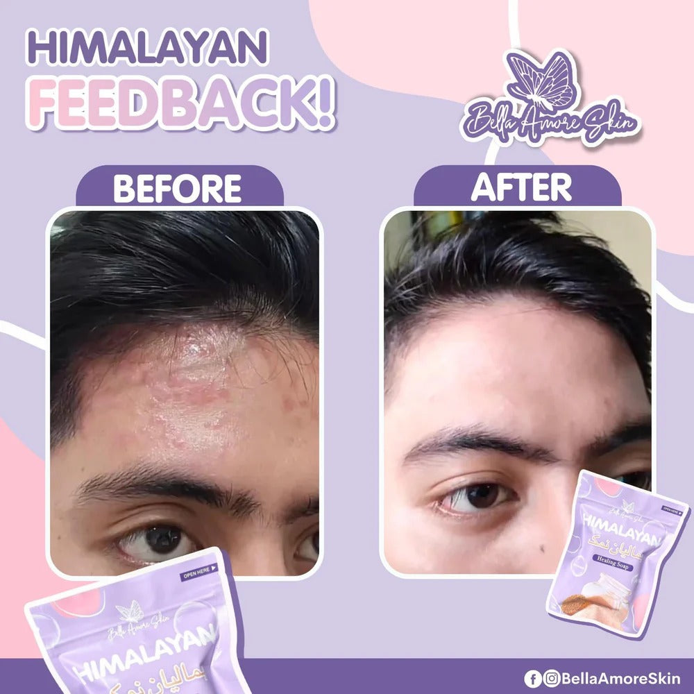 Bella Amore Himalayan Healing Soap Bella Amore Skin