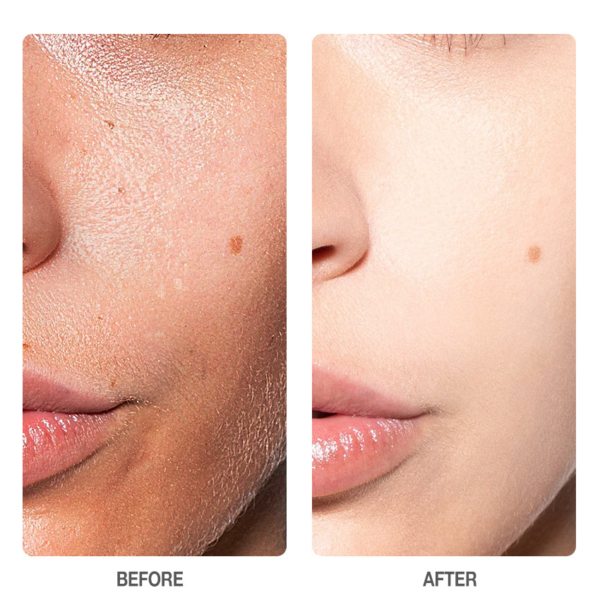 Skinever Salicylic Acid Refreshing Acne Skin Pads - 130ml Glo Arabia