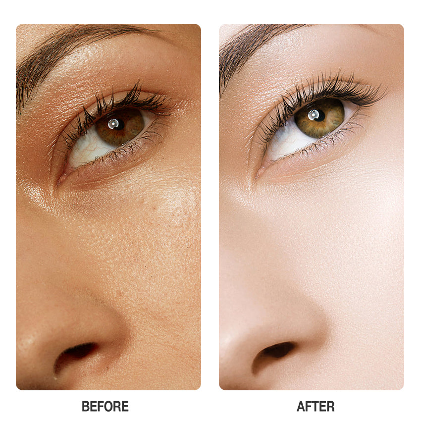 Skinever Vitamin C Brightening Serum - 20ml Skinever
