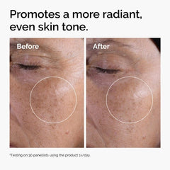 The Ordinary Glycolic Acid 7% Exfoliating Toner The Ordinary