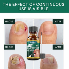 Rubriel Anti Paronychia Relief Oil - 10ml RUBRIEL