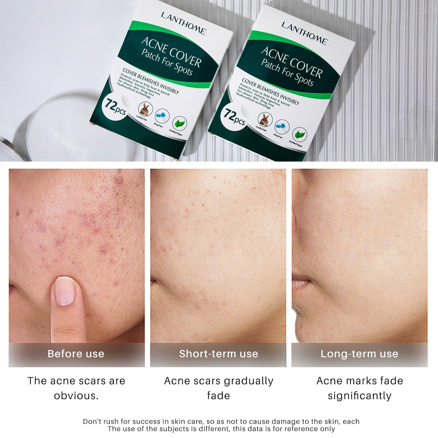 Lanthome Acne Cover Patch For Sports LANTHOME
