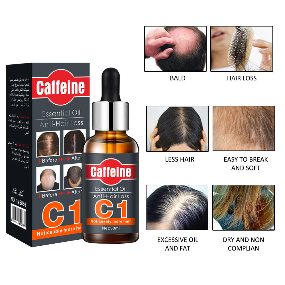 Caffeine Essential Oil Anti Hair Loss - 30ml Caffeine