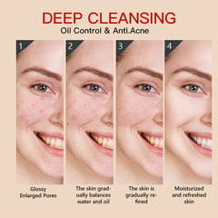Guanjing Kojic Acid Facial Wash - 100g GuanJing Beauty