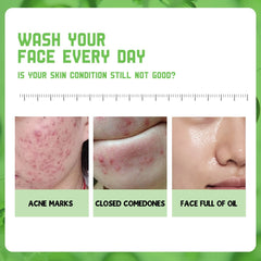 Disaar SA Anti-Acne Facial Wash - 200g Disaar