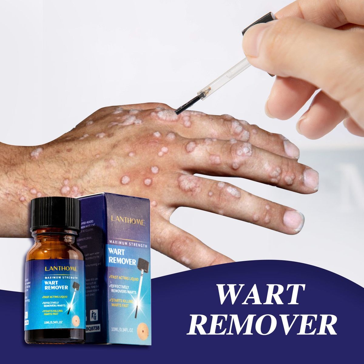 Lanthome Wart Remover - 10ml LANTHOME