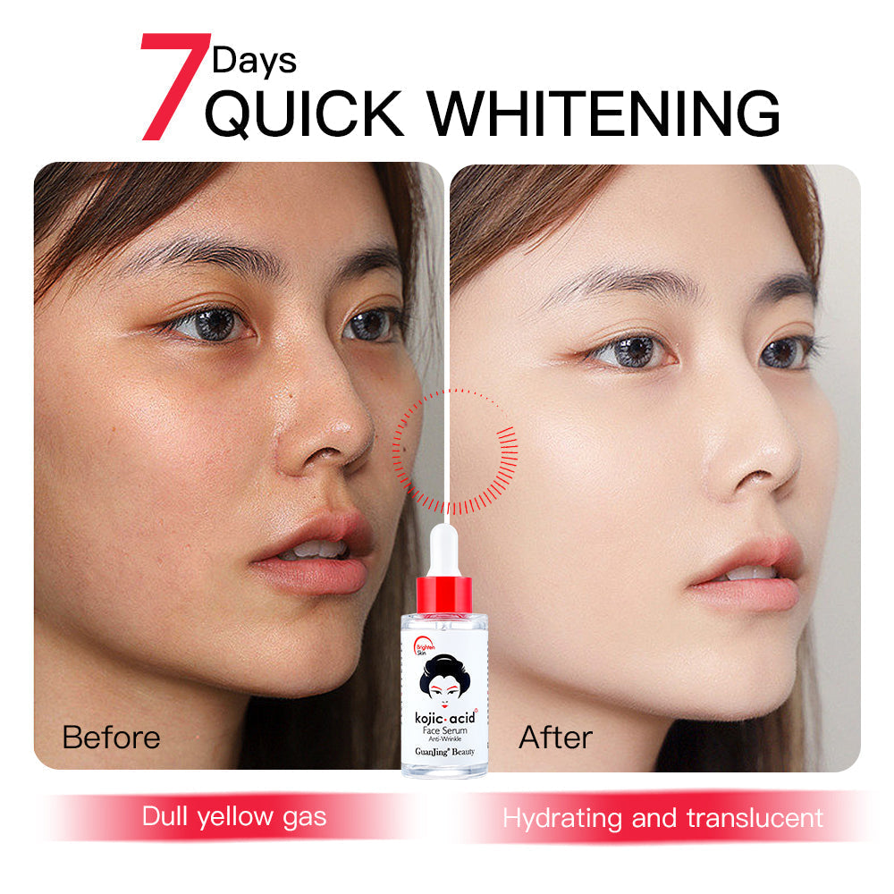 Guanjing Kojic Acid Face Serum - 40ml GuanJing Beauty
