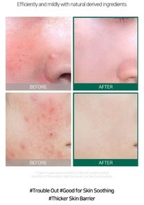 Some By Mi AHA.BHA.PHA 30Days Miracle Serum - 50ML SOME BY MI