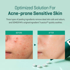 Some By Mi AHA.BHA.PHA 14Days Super Miracle Spot Kill Cream - 30ML SOME BY MI