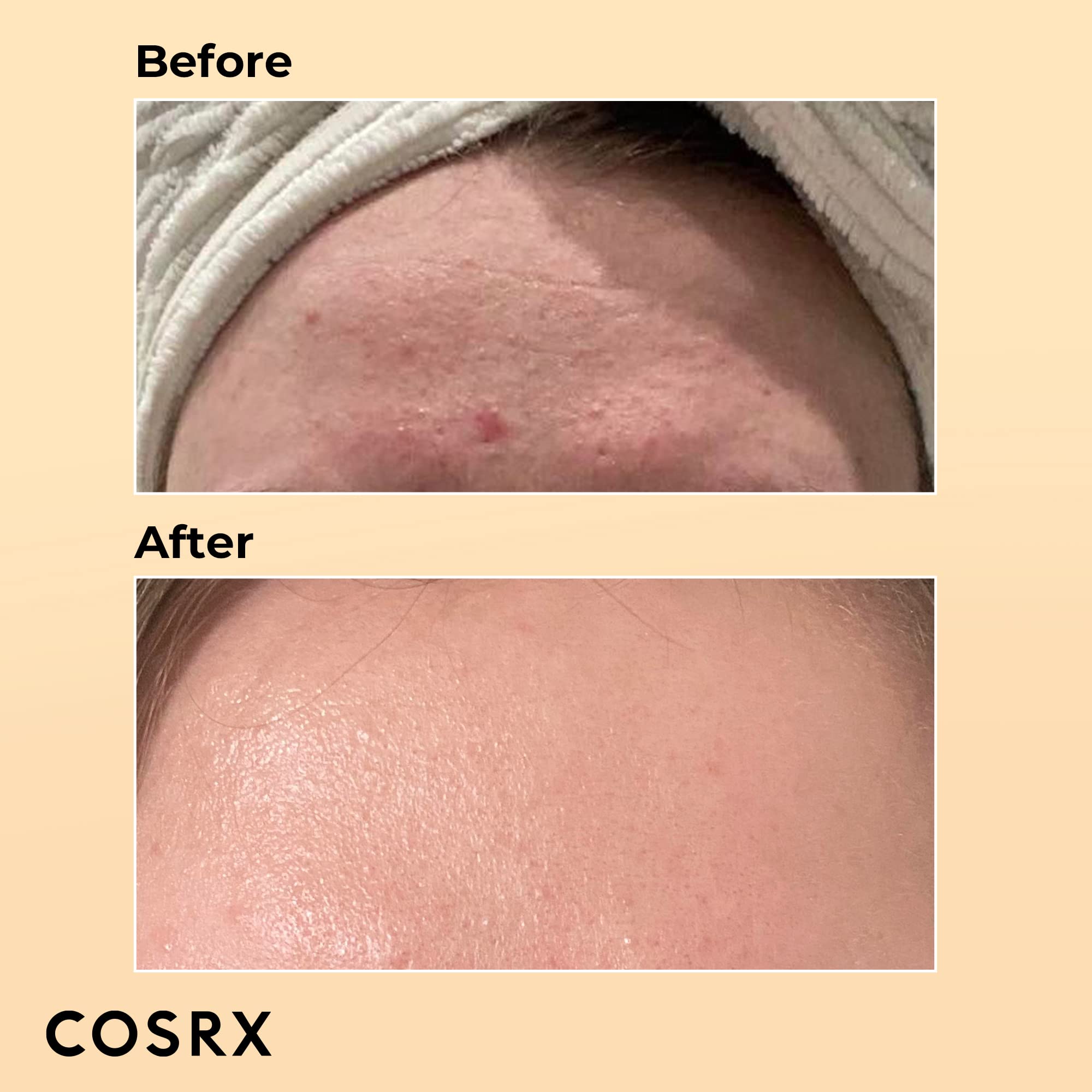 COSRX Advanced Snail Cream and Essence Combo COSRX