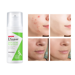 Disaar Anti-Acne Facial Serum - 50ml Disaar