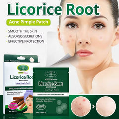Aichun Beauty LicoriceRoot Acne Pimple Patch Aichun Beauty