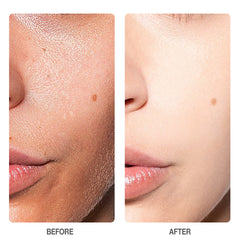 Skinever Salicylic Acid Refreshing Acne Skin Pads - 130ml Glo Arabia