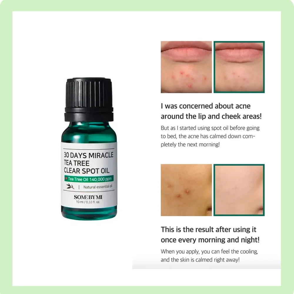 Some By Mi 30Days Miracle Tea Tree Clear Spot Oil -10ML SOME BY MI