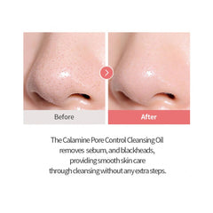Tocobo Calamine Pore Control Cleansing Oil - 20ml Tocobo