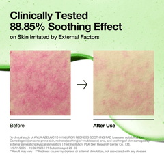 Anua Azelaic Acid 10 Hyaluron Redness Soothing Pad – 230ml (90 ea) Anua