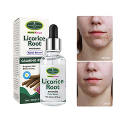 Aichun Beauty Licorice Root Facial Serum - 30ml Aichun Beauty