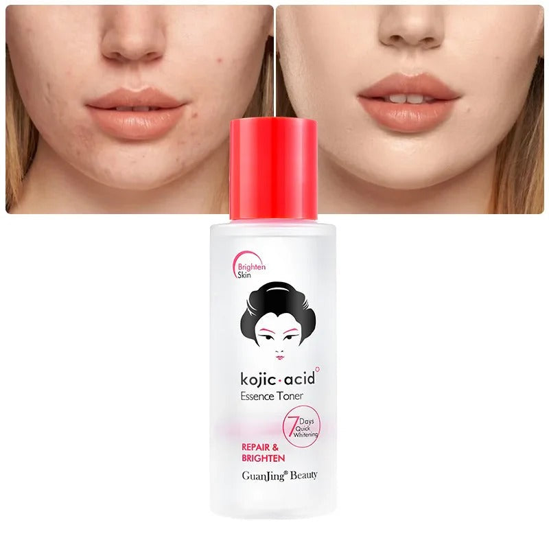 Guanjing Kojic Acid Essence Toner Repair & Brighten - 100ml GuanJing Beauty