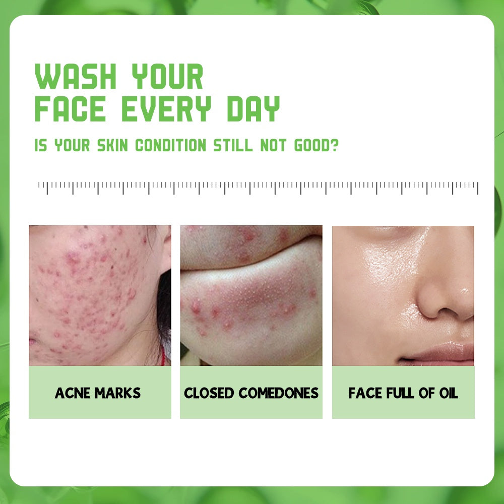 Disaar SA Anti-Acne Facial Wash - 200g Disaar